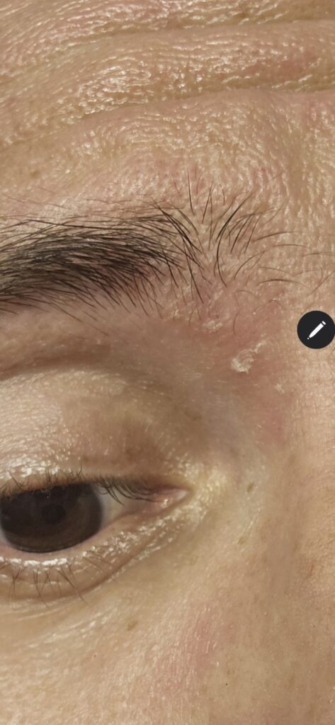VanMan's Tallow and Honey Balm review. Dry skin around the eye lids.